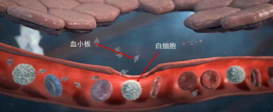关于干细胞治疗肺纤维化的5个临床研究案例