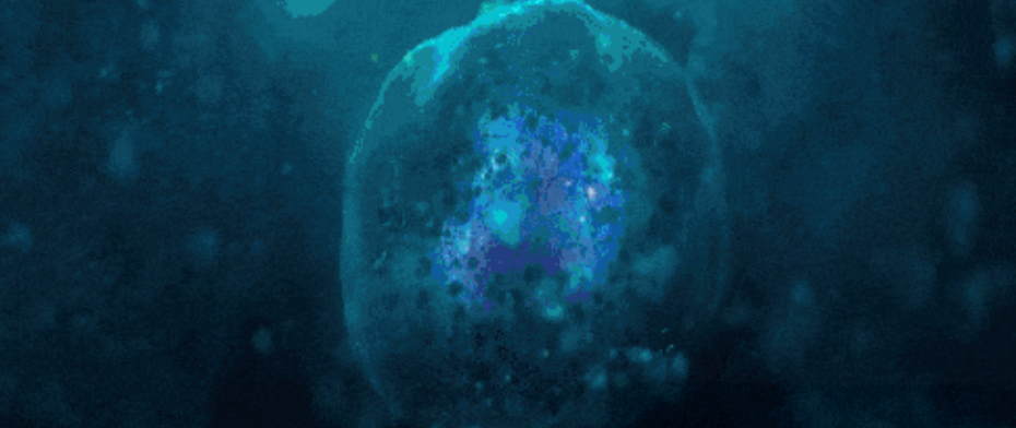 关于干细胞治疗肺纤维化的5个临床研究案例