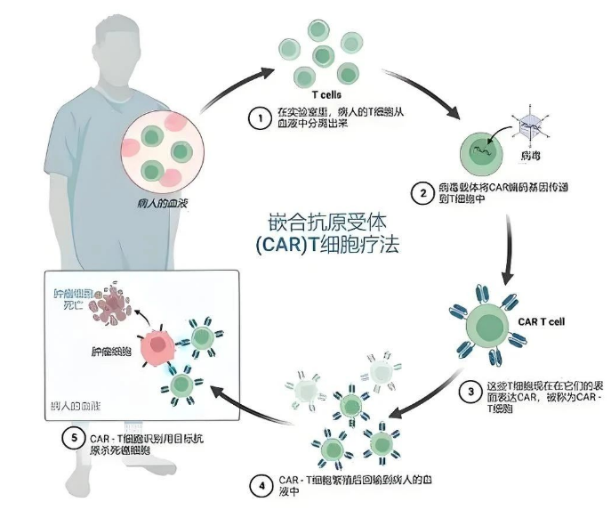 麻省理工评论：CAR-T细胞可以彻底改变各种疾病的治疗，只要我们能使它们更便宜