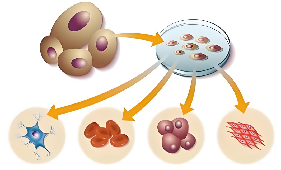 干细胞创新疗法助力帕金森病患者