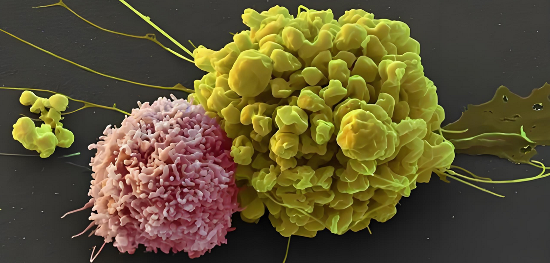 NK免疫细胞疗法预防和治疗肿瘤靠谱吗？回输后有哪些作用？