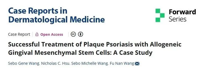 一项关于间充质干细胞治疗银屑病的相关案例报道