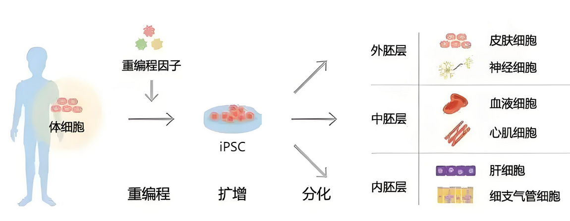 基于诱导多能干细胞（iPSC）治疗急性心肌梗死的临床前研究进展