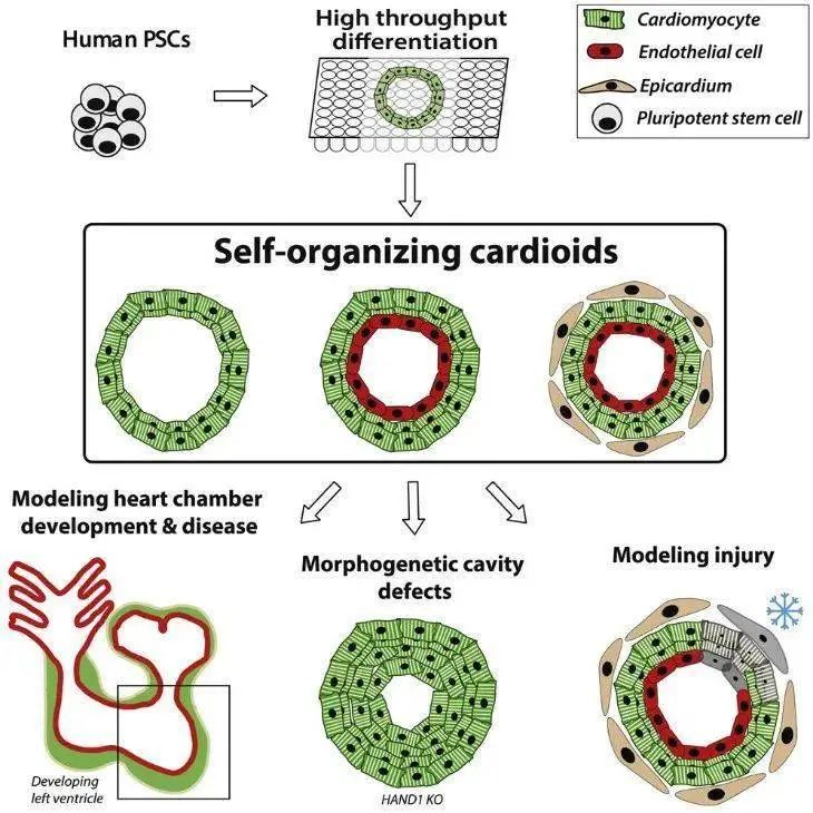 基于诱导多能干细胞（iPSC）治疗急性心肌梗死的临床前研究进展