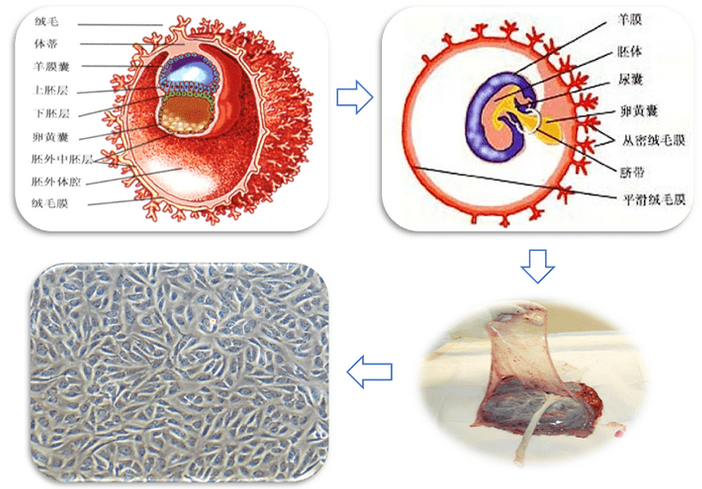 干细胞治疗子宫内膜损伤性不孕不育