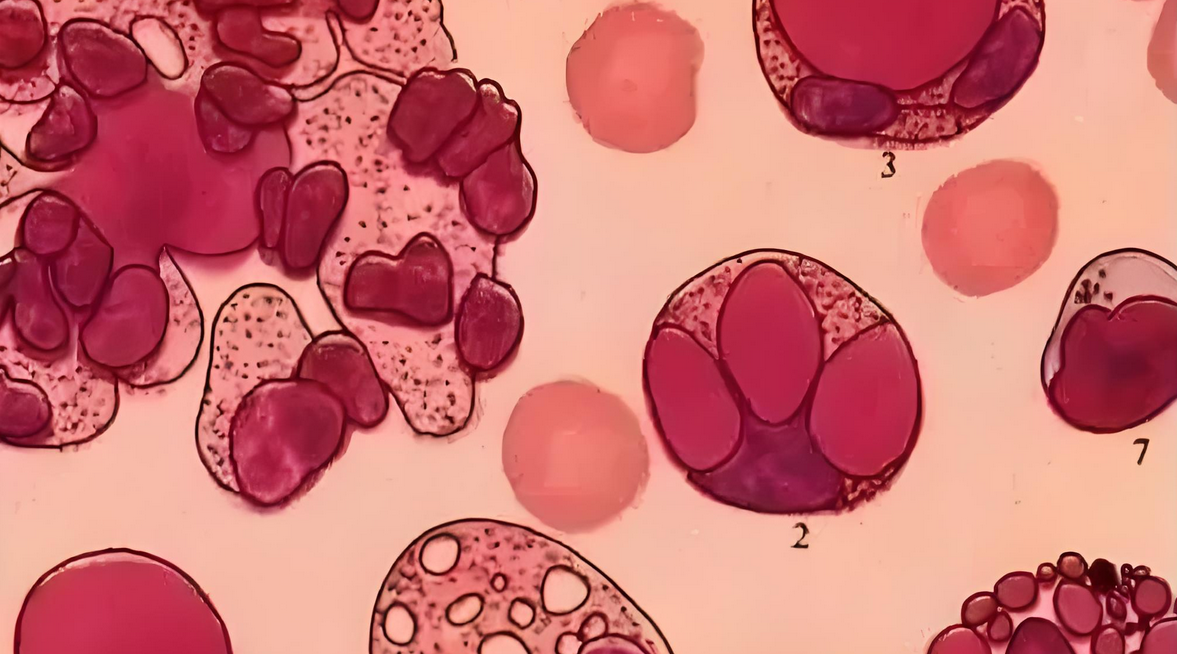 干细胞治疗子宫内膜损伤性不孕不育