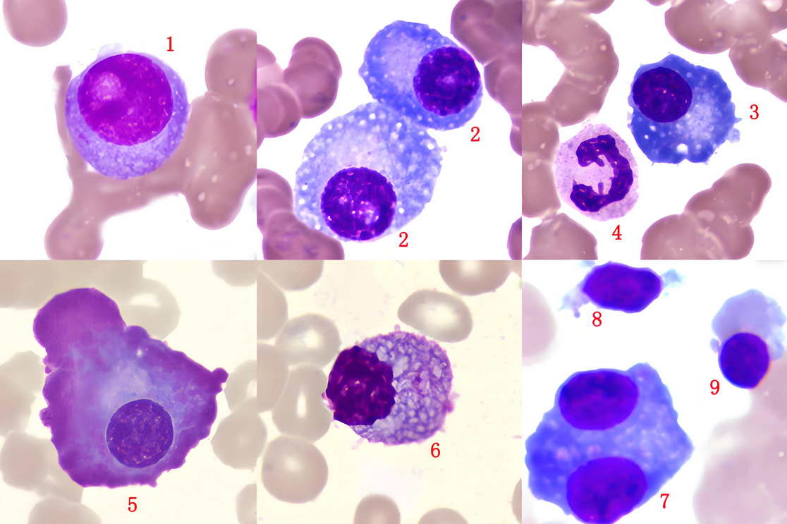 干细胞治疗子宫内膜损伤性不孕不育