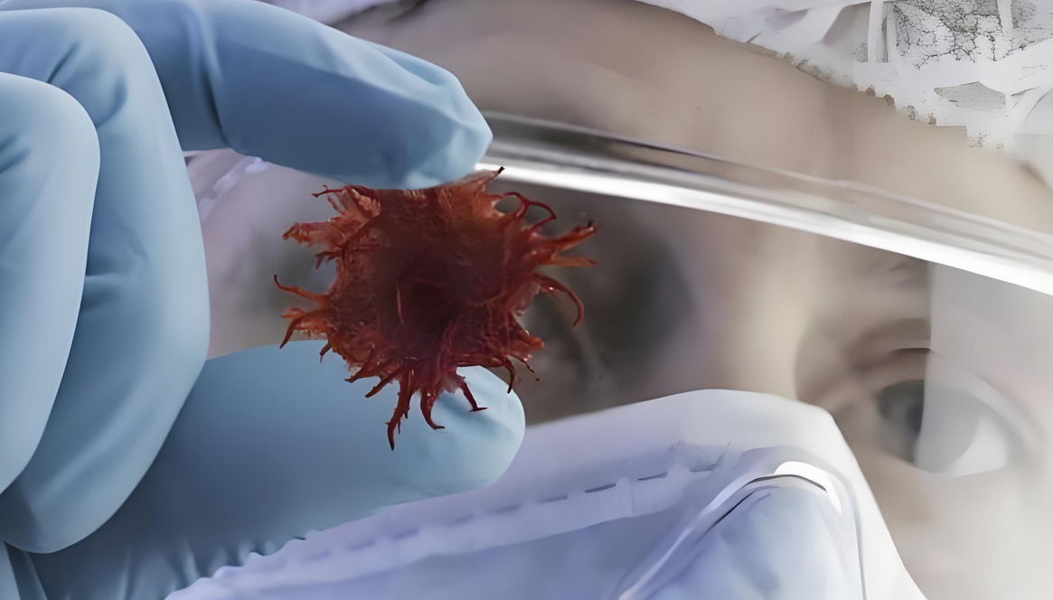 高达90%的癌症患者最终都死于癌症转移，用免疫细胞可以控制转移吗？