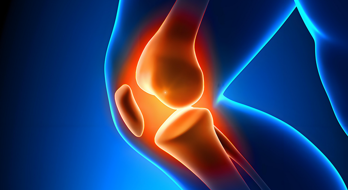 半月板损伤或许不用切除，多项研究案例表明干细胞可修复半月板损伤