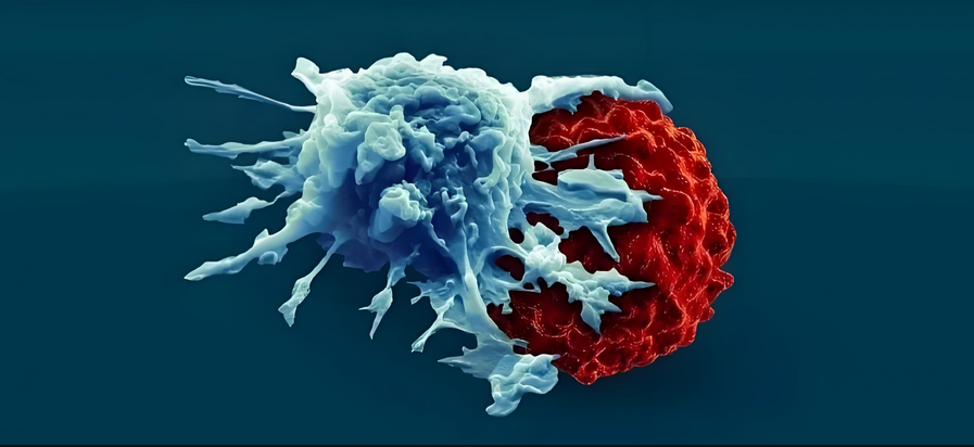 北京协和医院通过研究分析了1068人后，证明了回输NK细胞的必要性