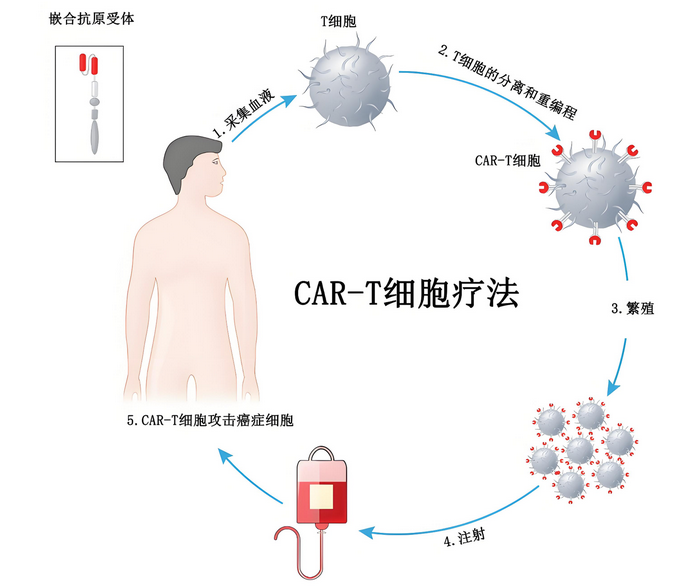 Cell子刊：诱导多能干细胞iPSC来源的CAR-T细胞抗肿瘤效果更强、持久性更高！