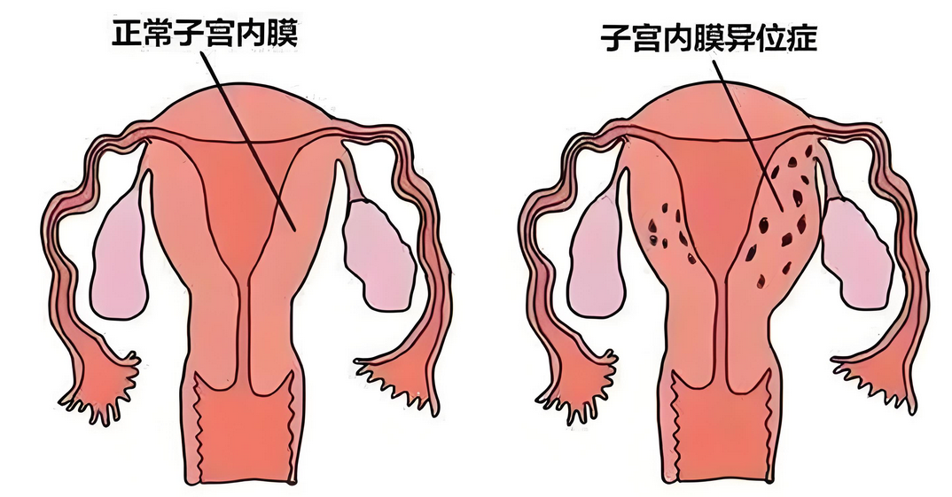 干细胞在女性不孕症中的研究应用